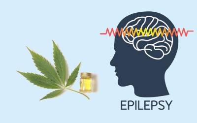 5 Best CBD Oils to Help Manage Epilepsy
